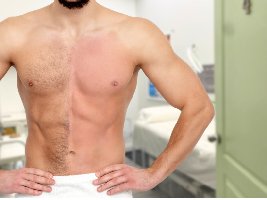 Before and after waxing results on a male chest