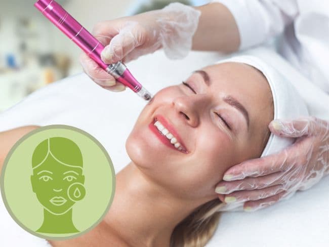 Women face smiling receiving a micro needling treatment by a aesthetician wearing gloves